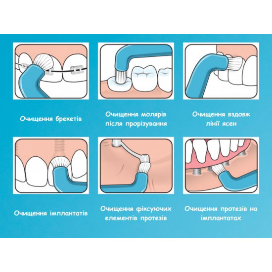 Монопучкова зубна щітка TePe Compact Tuft Біла (432368) (7317400002446) Монопучкова зубна щітка TePe Compact Tuft Біла (432368) (7317400002446)