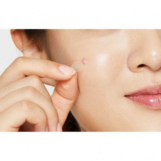 Patches from an acne of COSRX Clear Fit Master Patch, 18 pieces Patches from an acne of COSRX Clear Fit Master Patch, 18 pieces
